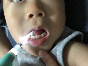 Aidee 電動歯ブラシ　LEDライト付きで見やすい